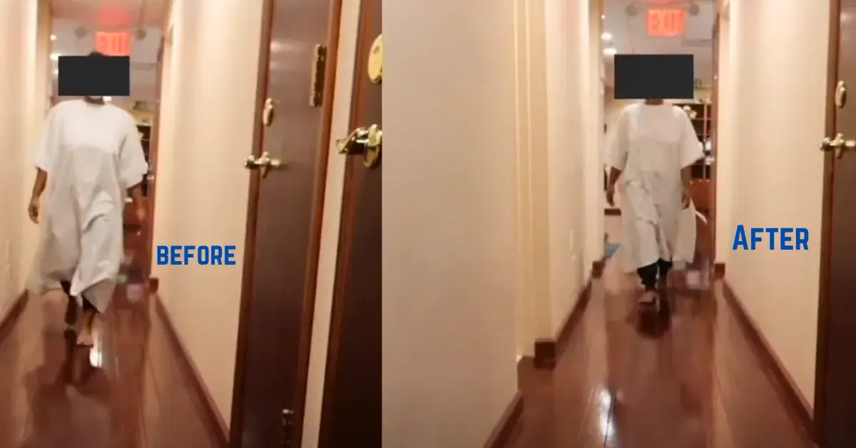 Before and after results of chiropractic scoliosis treatment showing patient walking in a hallway.