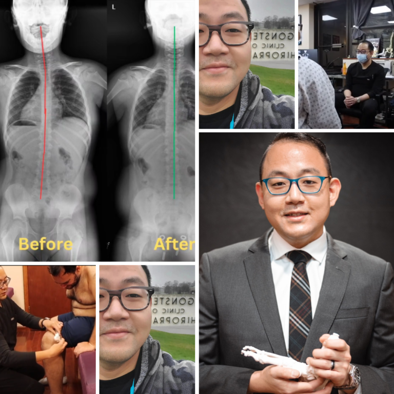 A collage featuring chiropractic treatments, X-rays, and a professional portrait of a chiropractor.